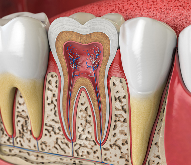 Dental cross-section model showing tooth anatomy with pulp, dentin, and root structure